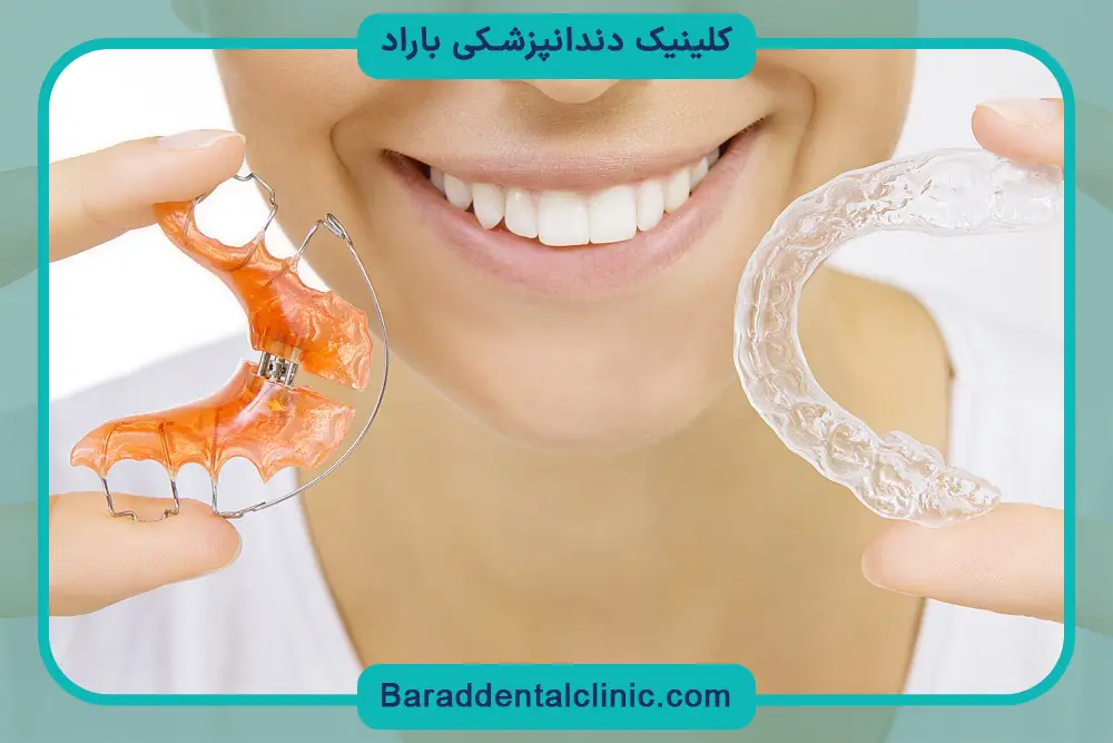 عوامل موثر بر قیمت ارتودنسی ثابت و متحرک 