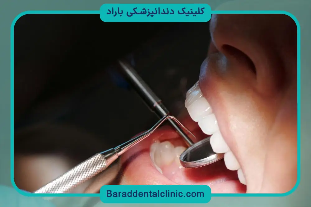 ایمپلنت دندان چقدر هزینه دارد؟ بررسی عوامل