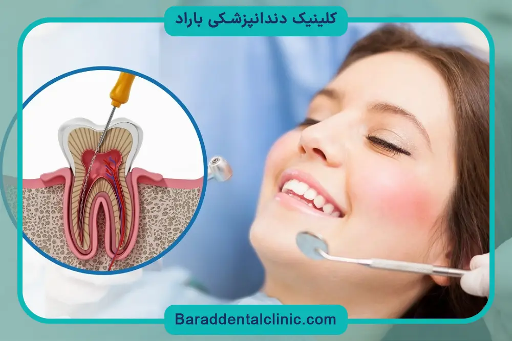 دلایل نیاز به درمان ریشه