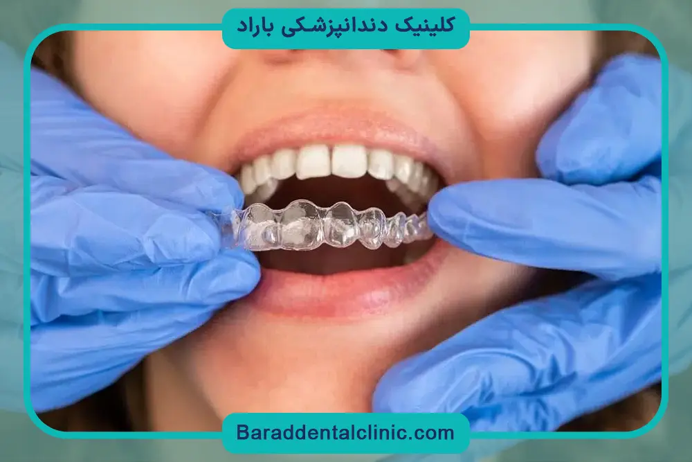 هزینه سیم کشی دندان و درمان‌های تکمیلی