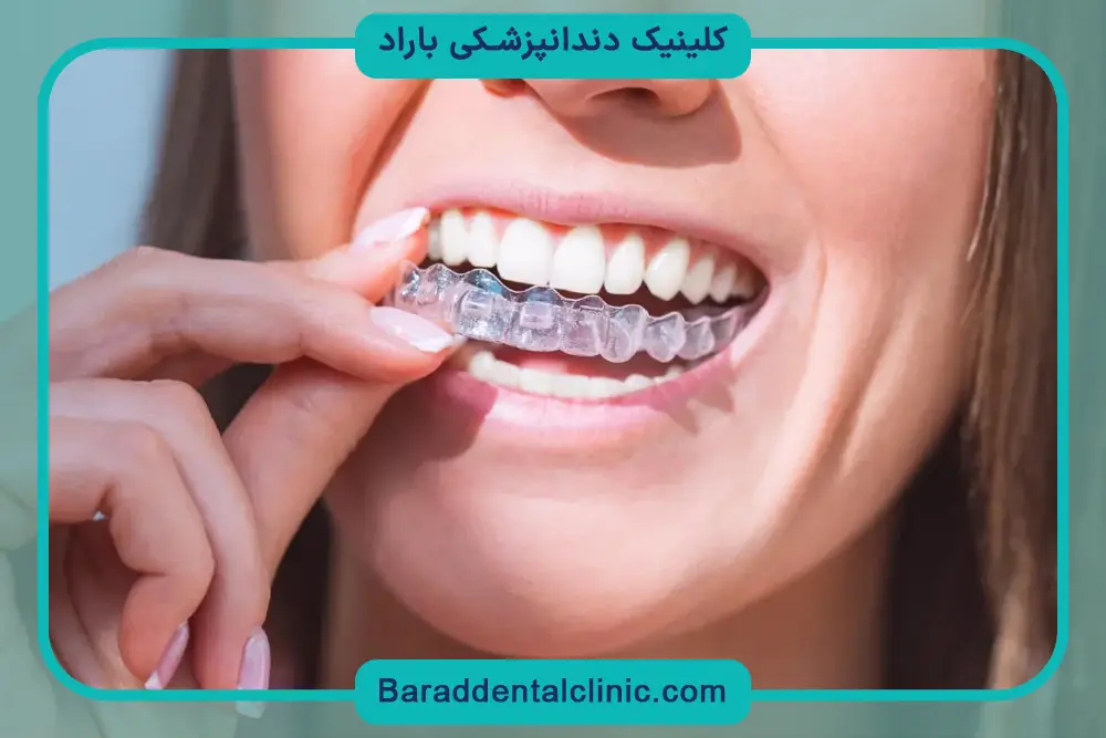 تاثیر سن روی هزینه ارتودنسی 