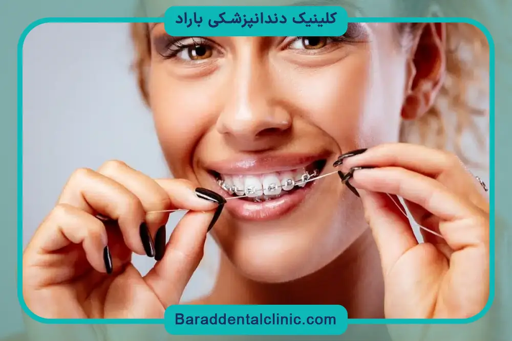 تاثیر هزینه‌های جانبی روی قیمت ارتودنسی ثابت و متحرک 