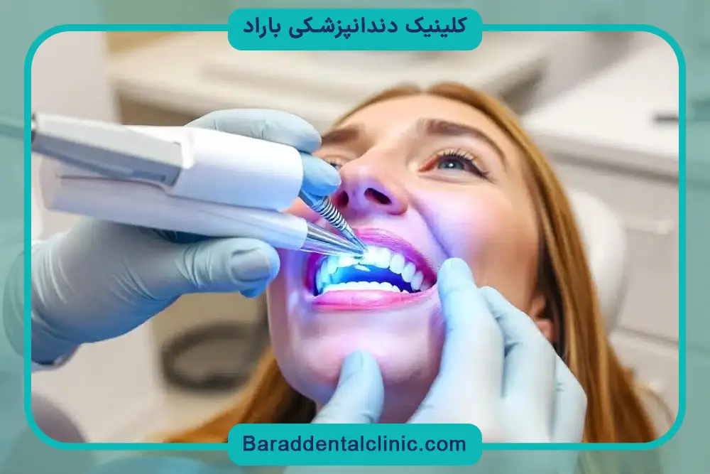 آشنایی با بلیچینگ دندان