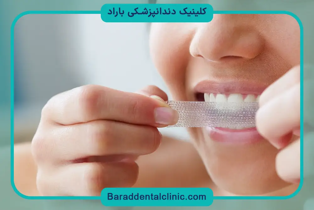 مزایای بلیچینگ دندان