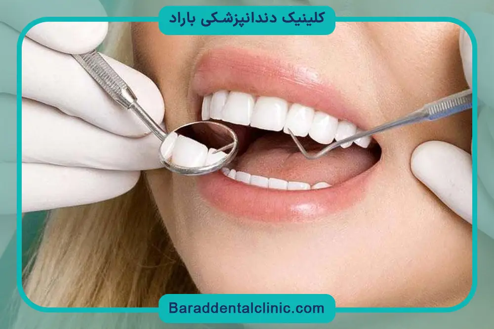 انتخاب دندانپزشک در خدمات کامپوزیت دندان 