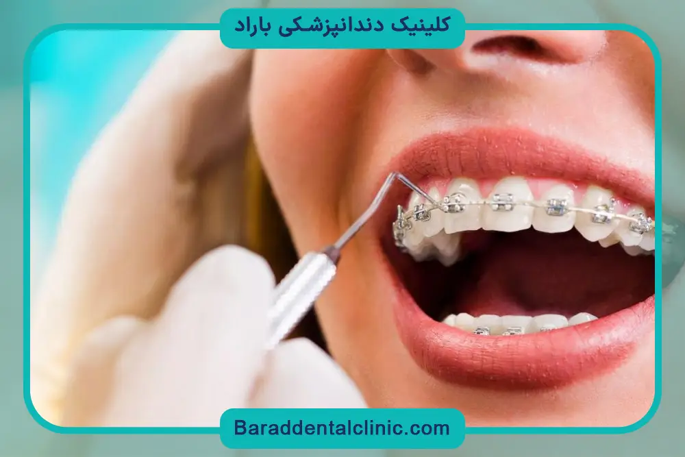 بررسی عوارض در مراقبت بعد از رگلاژ 