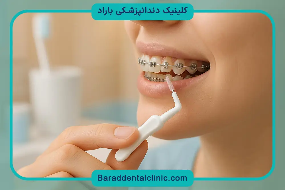 نحوه استفاده از مسواک ارتودنسی 