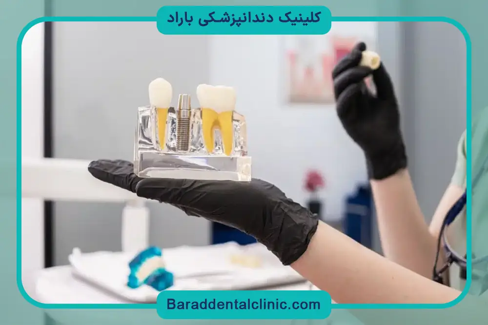 جویدن با دندان ایمپلنت برای غذاهای سفت