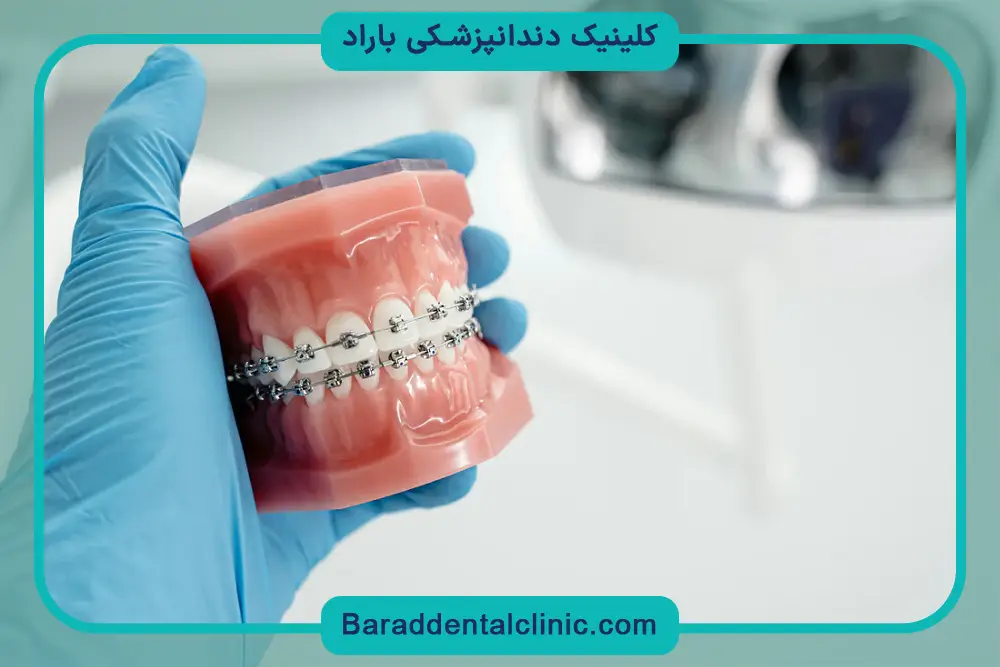 اشتباهات رایج در استفاده از نخ دندان ارتودنسی 