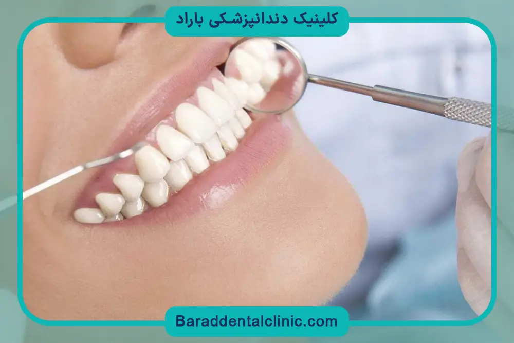 کاشت دندان اقساطی