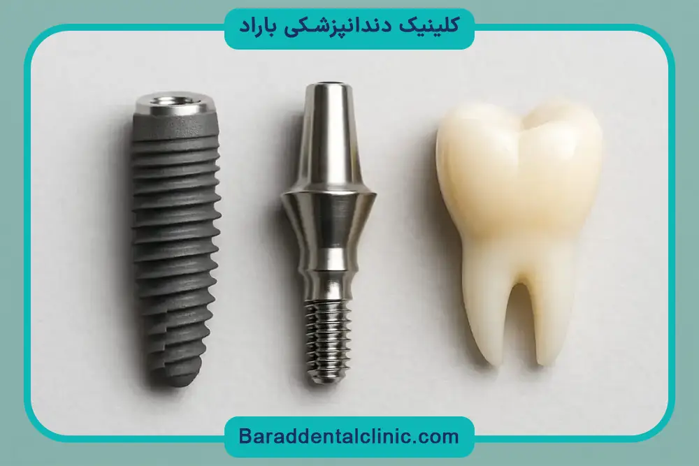 فیکسچر ایمپلنت دندان