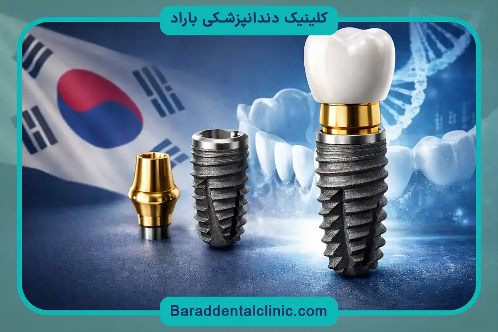 فیکسچر ایمپلنت کره ای چیست؟