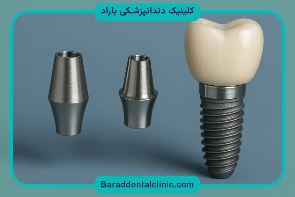 فیکسچر ایمپلنت چیست؟ آشنایی کلی