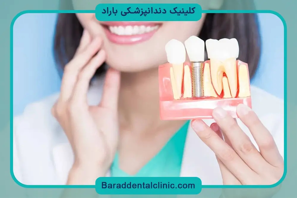 نحوه انجام کاشت دندان ارزان 