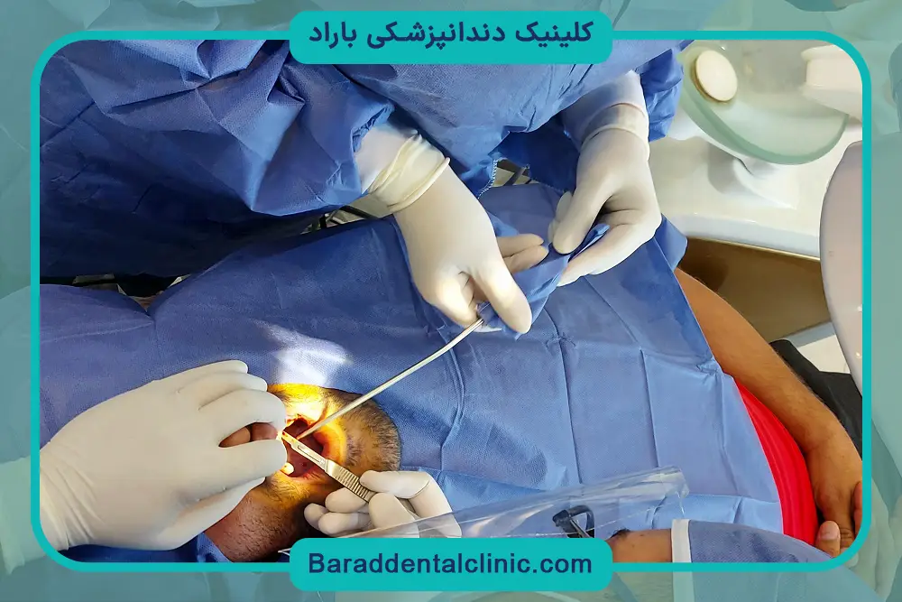 نقش سینوس در جراحی ایمپلنت فک بالا 