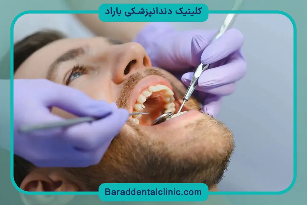 انواع متریال فیکسچر دندان چیست؟