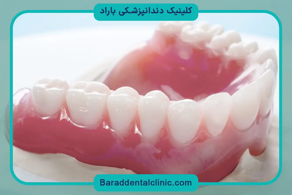 عوامل موثر بر قیمت کاشت دندان با چسب