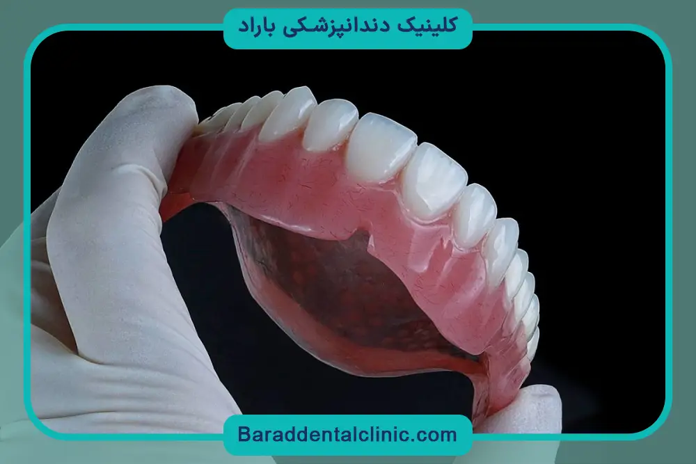 انواع پایه دندان مصنوعی 