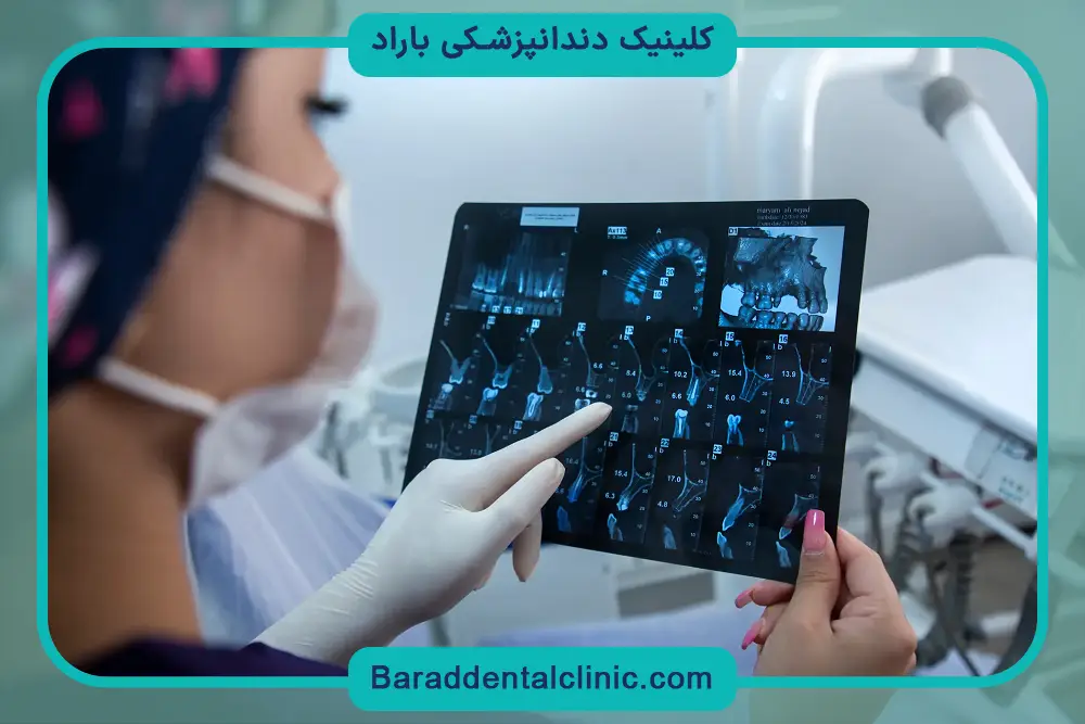 مراحل کاشت دندان ایمپلنت دیجیتال