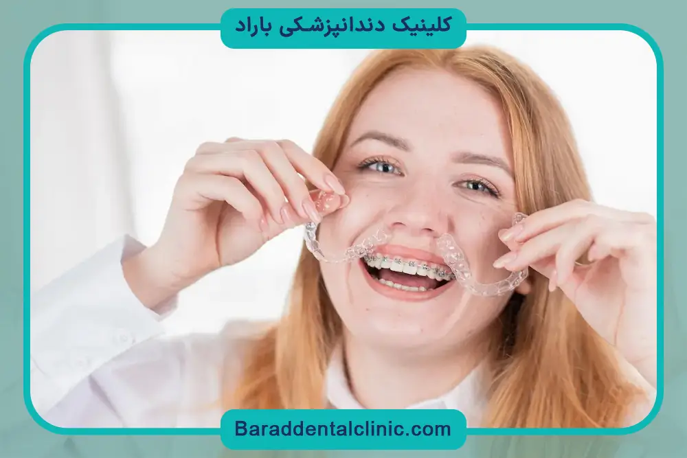 مزایای براکت نامرئی دندان 