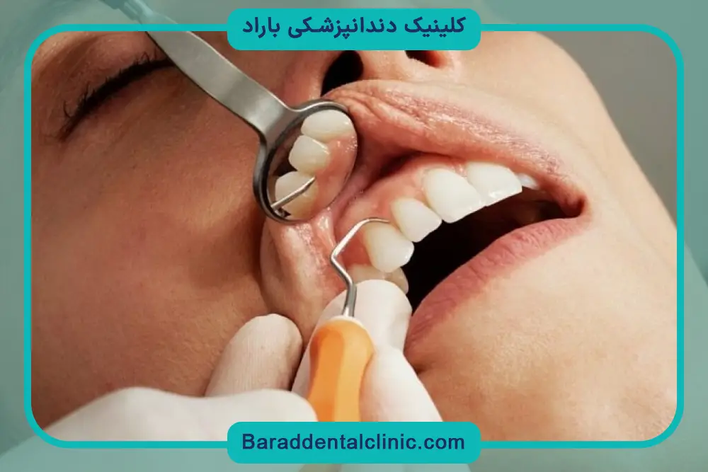 شرایط نیاز به پایه دندان برای عصب کشی 