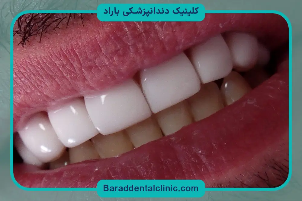 کامپوزیت جنت آباد