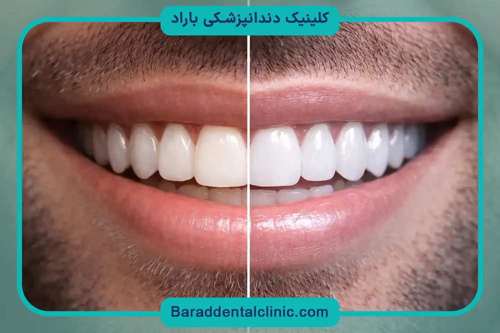 کامپوزیت تهران