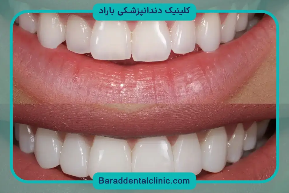 کامپوزیت پاسداران