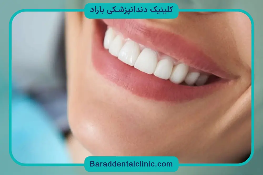 کامپوزیت قیطریه