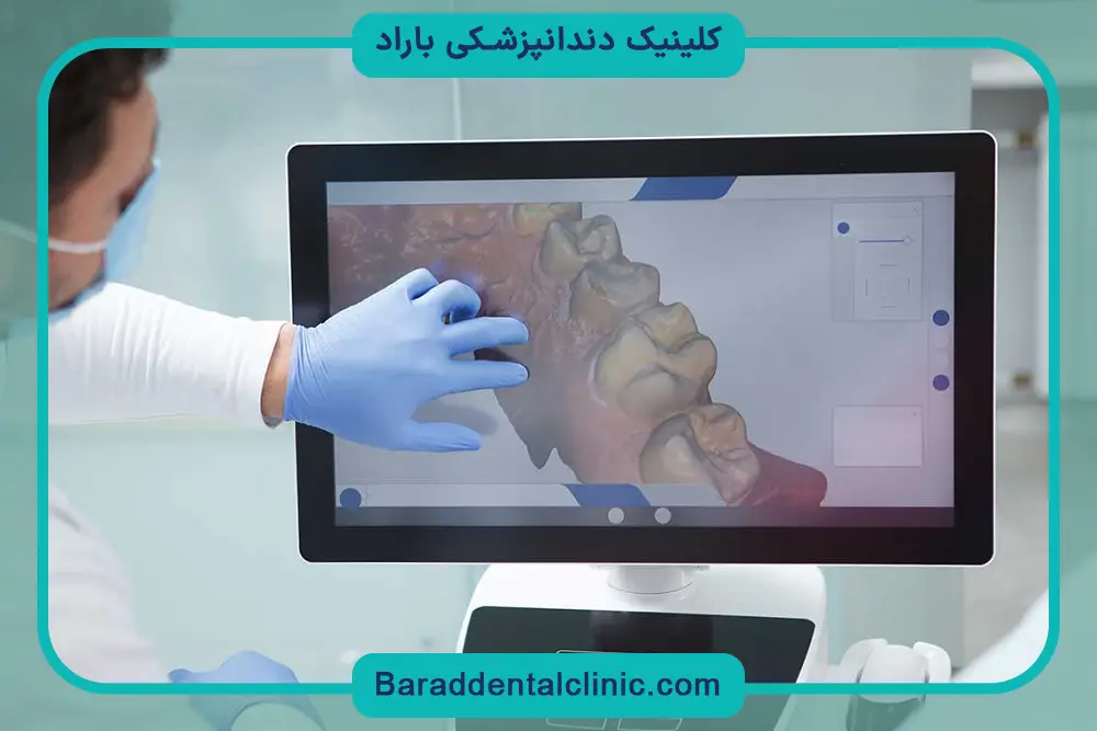 اهمیت انتخاب بهترین دکتر ایمپلنت دیجیتال در تهران 