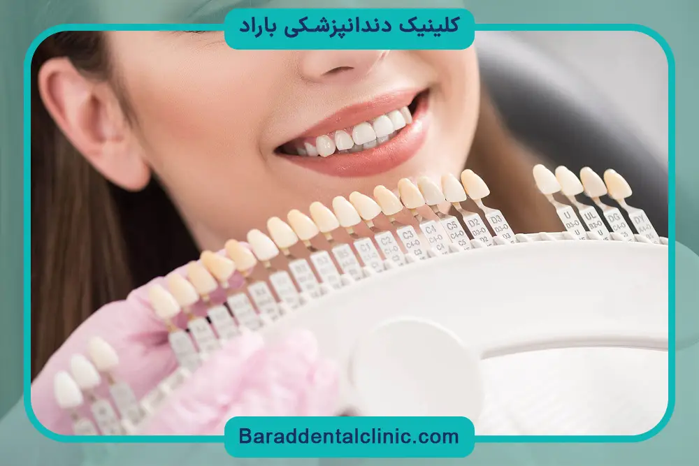 بهترین کلینیک‌های کامپوزیت جنت آباد