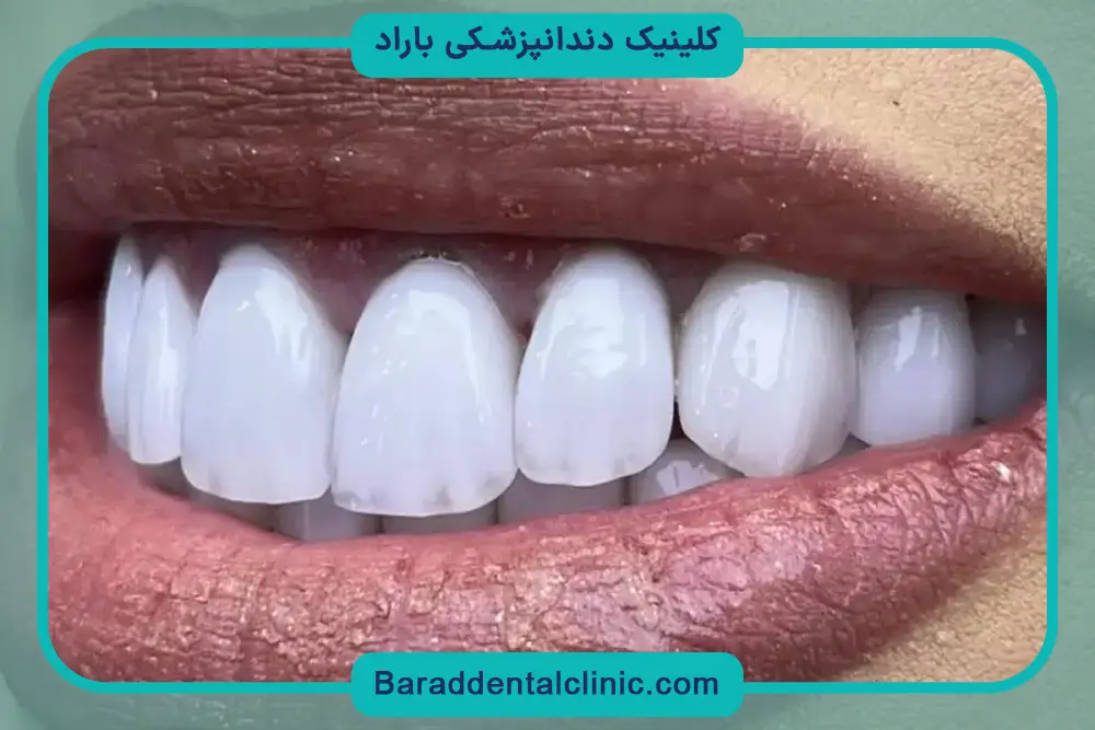 خدمات کامپوزیت پاسداران 