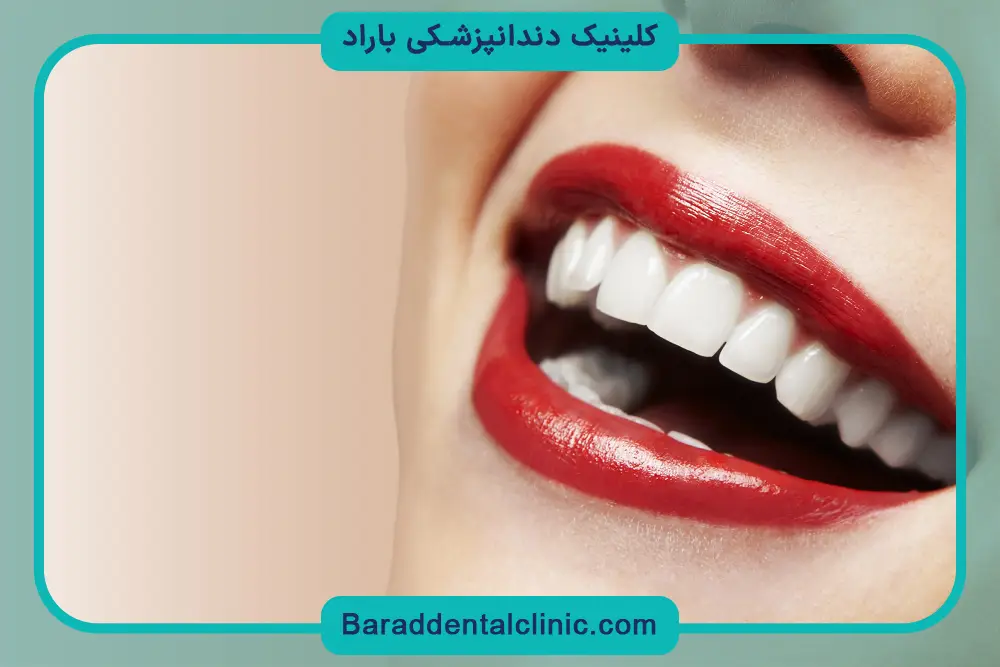 اهمیت کامپوزیت قیطریه
