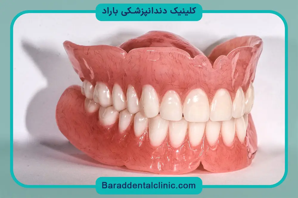 عوامل موثر بر هزینه بازسازی دندان