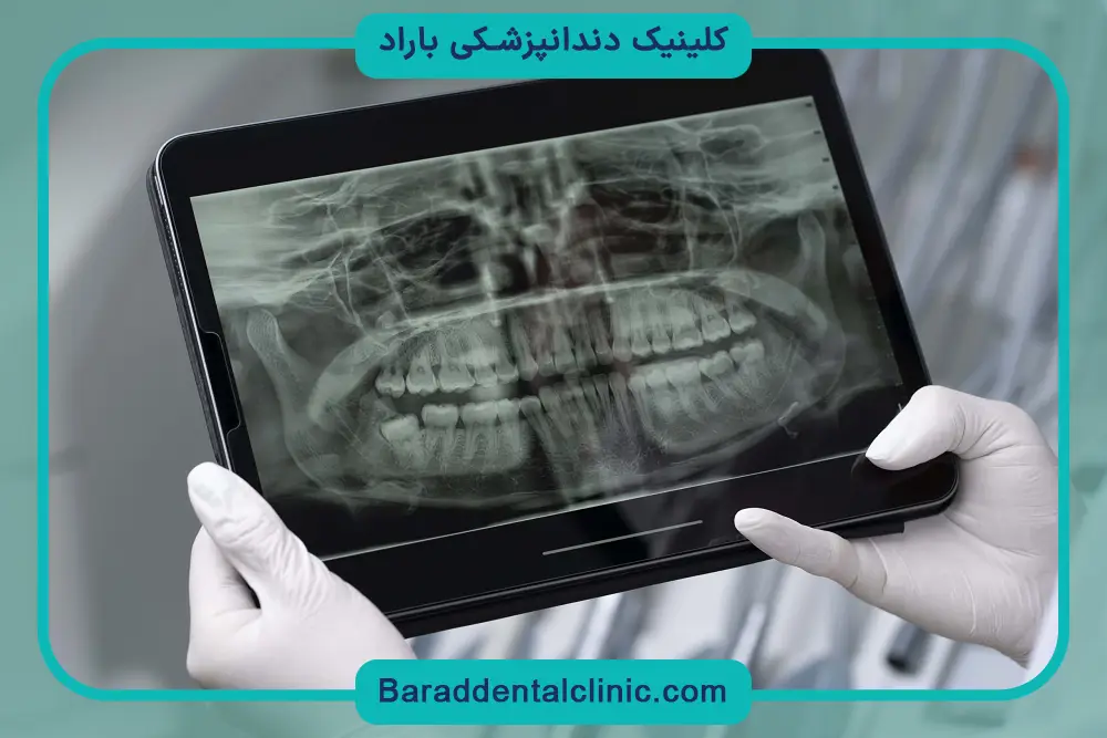 بررسی تفاوت ایمپلنت دیجیتال و معمولی 