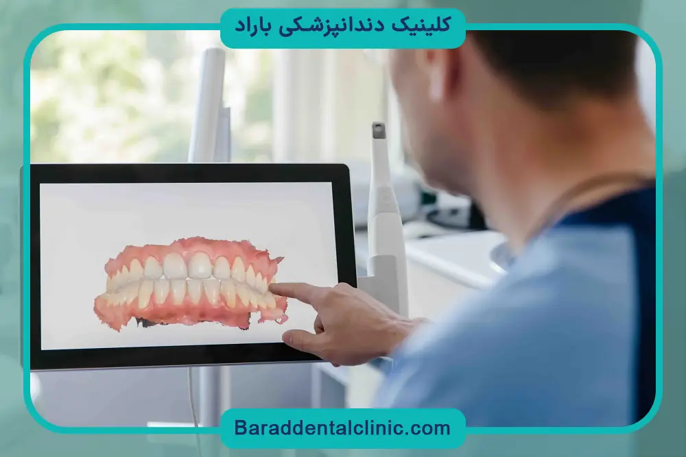 ایمپلنت دیجیتال خوبه یا سنتی? بررسی تفاوت‌ها