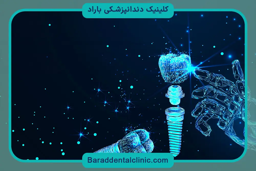 فرق ایمپلنت دیجیتال با پانچ از نظر مدت درمان
