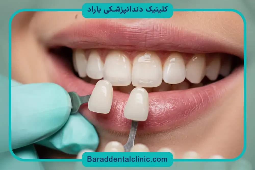 مراحل کامپوزیت قیطریه