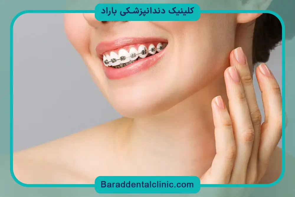 انواع روش‌های سیم کشی دندان تکی 