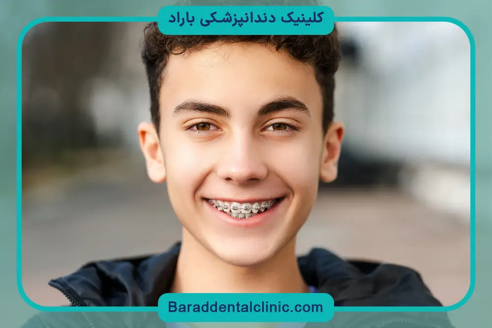 تاثیر تخصص جراح روی قیمت سیم کشی دندان پسرانه 