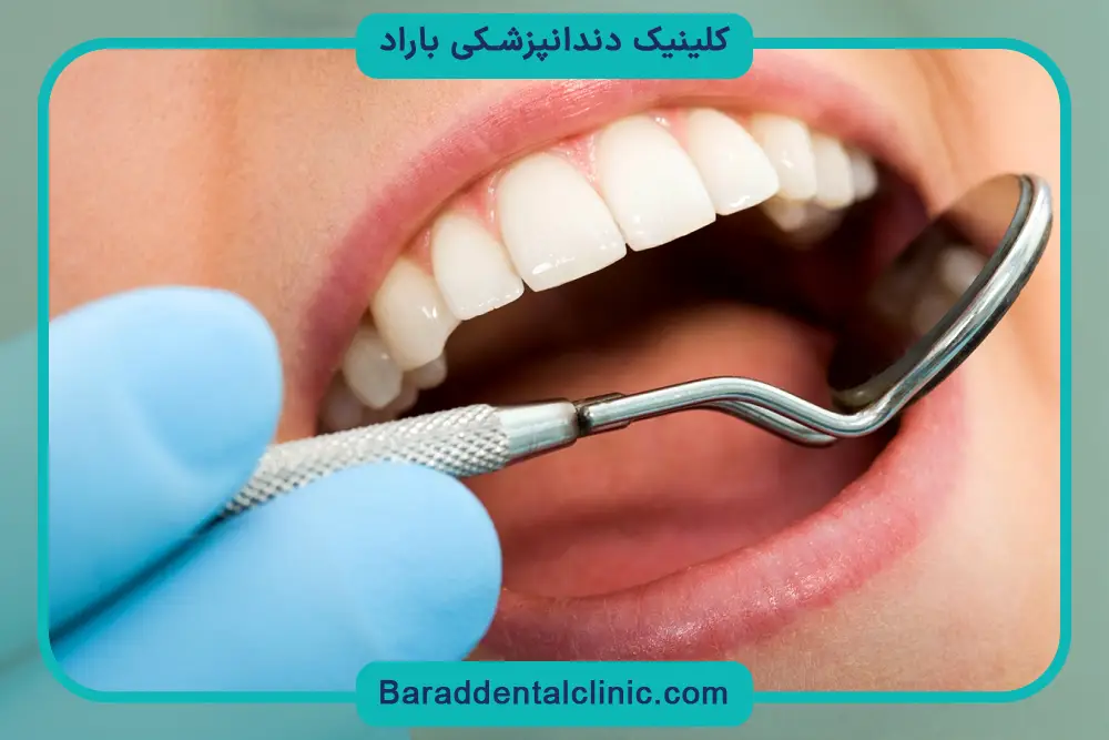 هزینه کامپوزیت پاسداران 