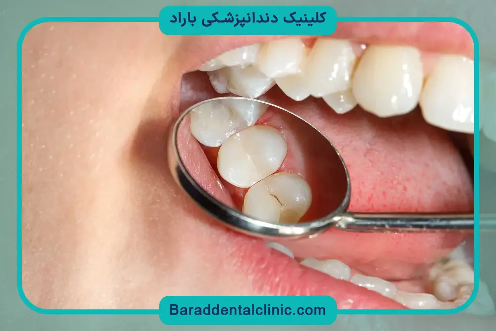 مدیریت هزینه بازسازی دندان
