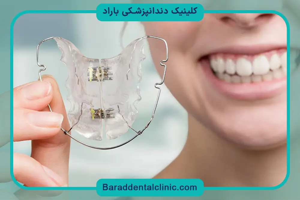 روش‌های پرداخت قیمت سیم کشی دندان فک پایین 