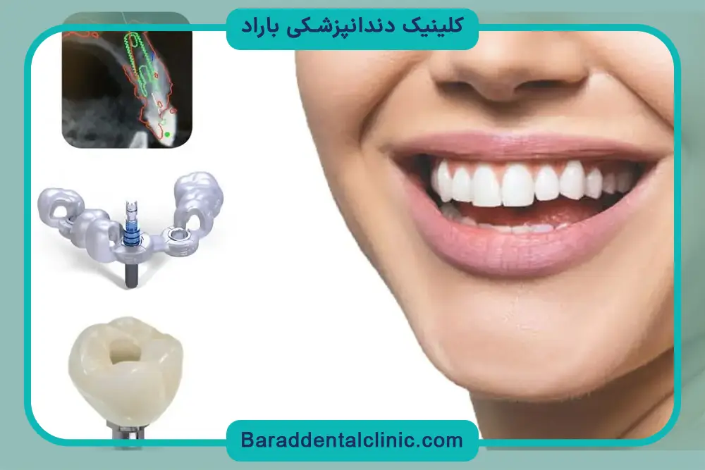 محدودیت‌های ایمپلنت دیجیتال دندان چیست؟