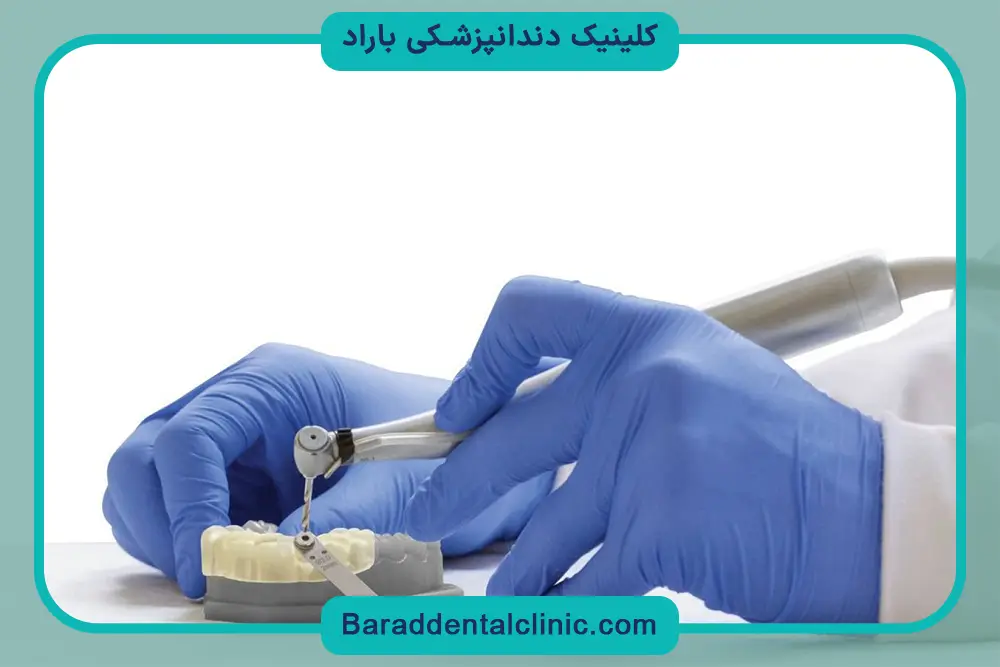 ایمپلنت دیجیتال خوبه یا سنتی؟ محدودیت‌های ایمپلنت دیجیتال