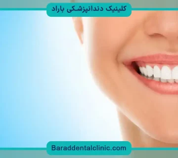 قیمت باندینگ دندان