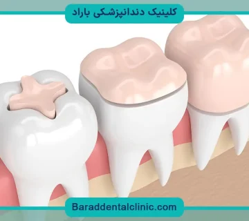 داروی بازسازی دندان