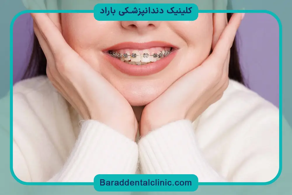 قیمت سیم کشی دو دندان جلو