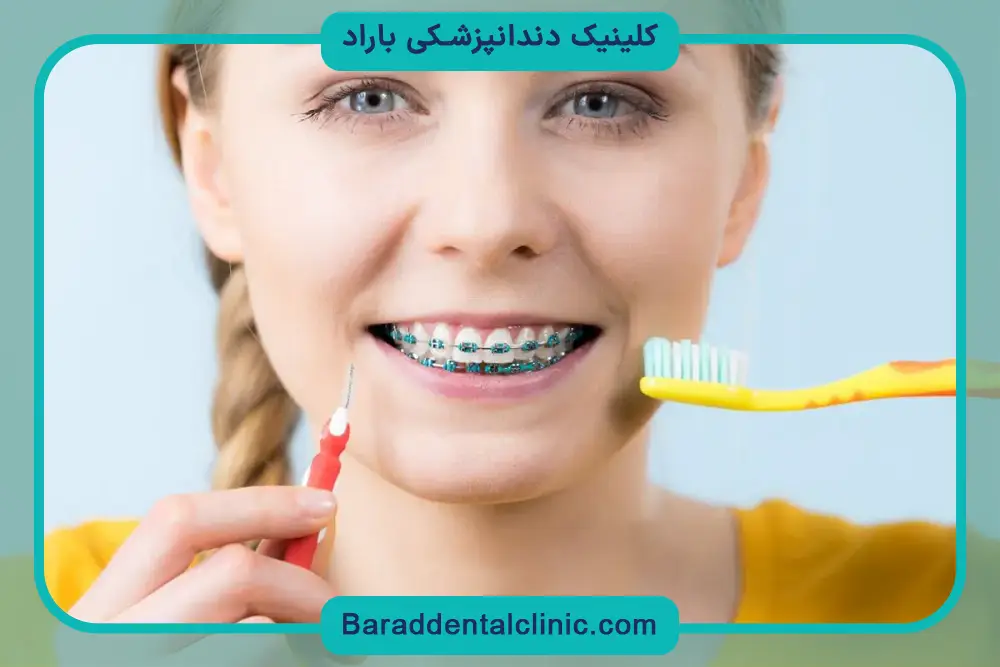 مزایا و محدودیت‌های سیم کشی تک دندان 