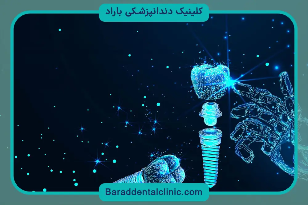 ایمپلنت دیجیتال چقدر طول میکشه؟ بررسی زمان کلی